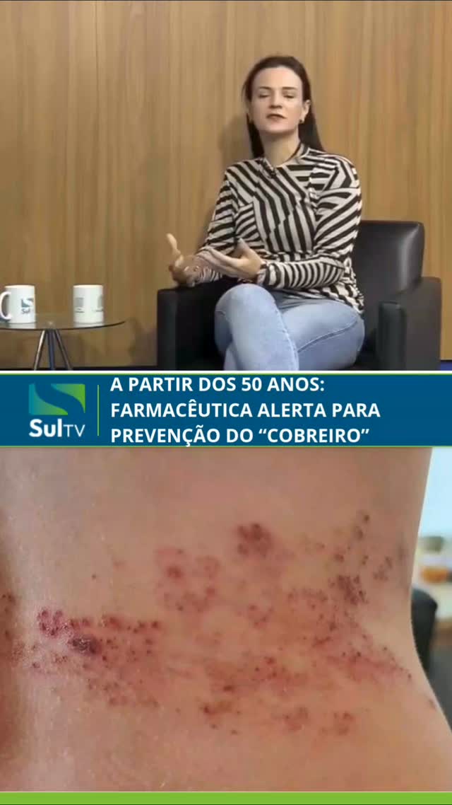 O herpes-zóster, conhecido como “cobreiro”, pode causar consequências que vão muito além das bolhas na pele. A farmacêu…